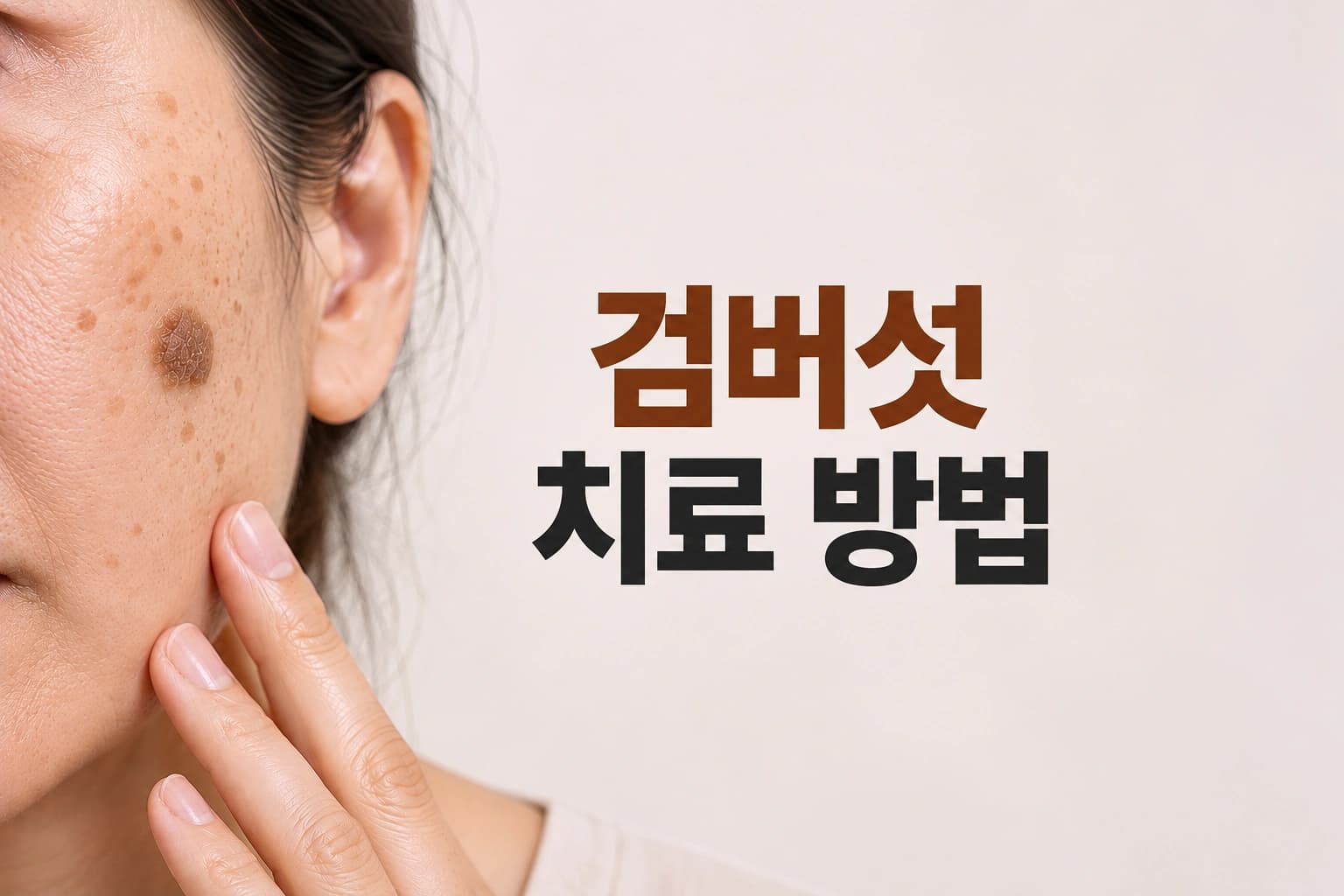 얼굴의 검버섯 병변과 검버섯 치료 방법을 나타낸 썸네일 이미지