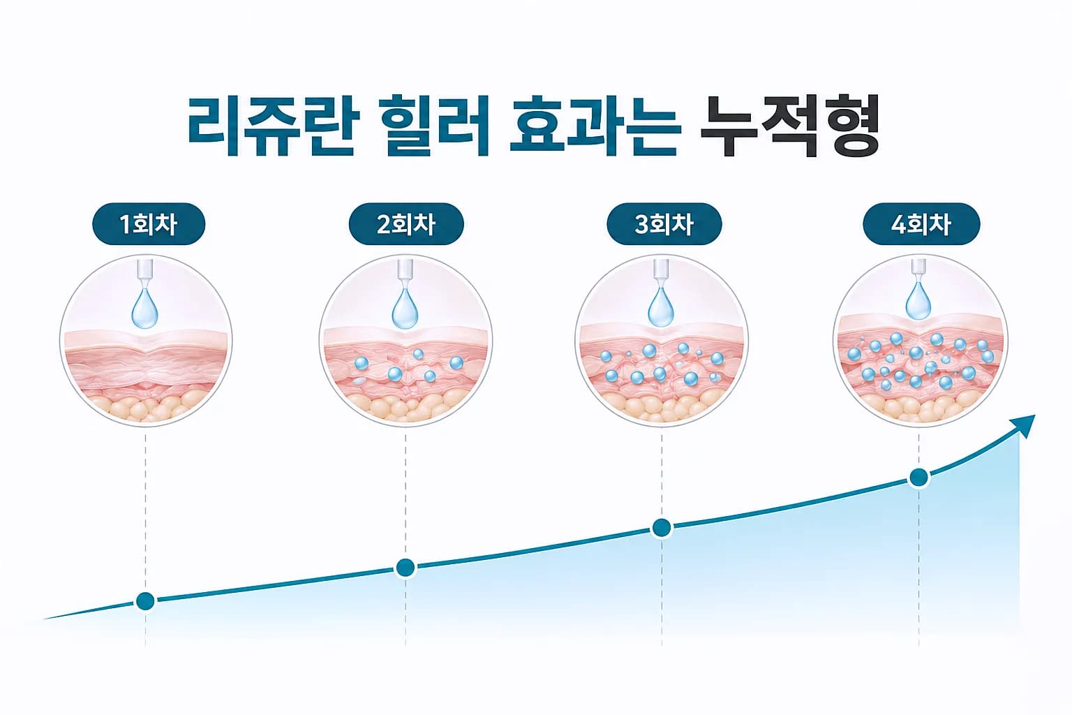 리쥬란 힐러 효과가 시술 횟수에 따라 누적되며 나타나는 시간별 변화 그래프